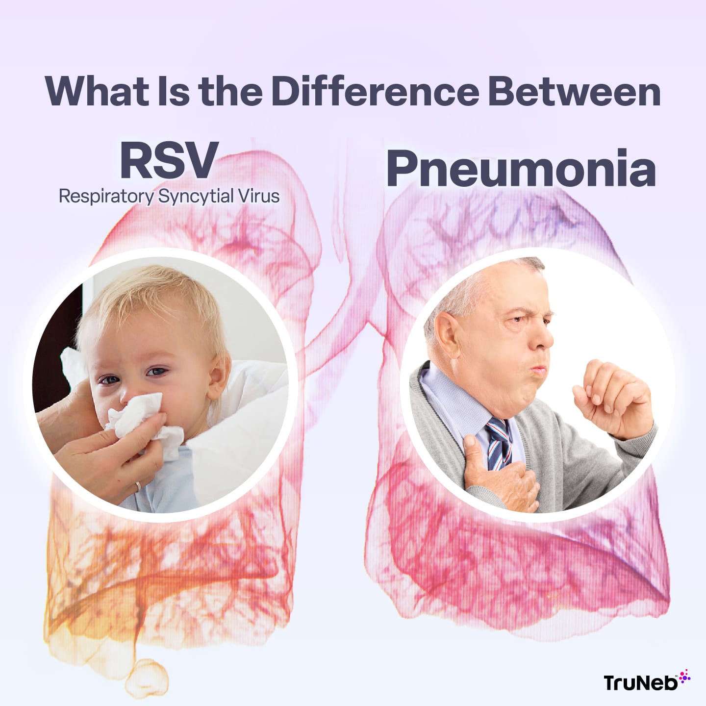 What Is the Difference Between RSV and Pneumonia?