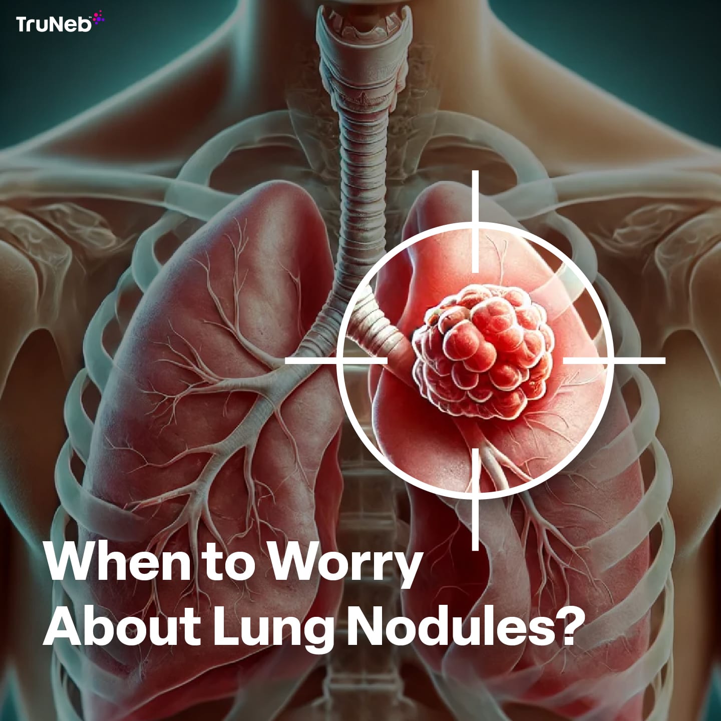 When to Worry About Lung Nodules: A Comprehensive Guide